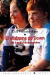 SINDROME DE DOWN, EL | 9788475096124 | CUNNINGHAM, CLIFF