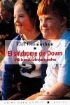 SINDROME DE DOWN, EL | 9788475096124 | CUNNINGHAM, CLIFF